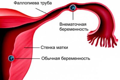 Фото: Признаки и симптомы